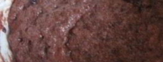 печеночные котлеты из говяжьей печени. Шаг 6